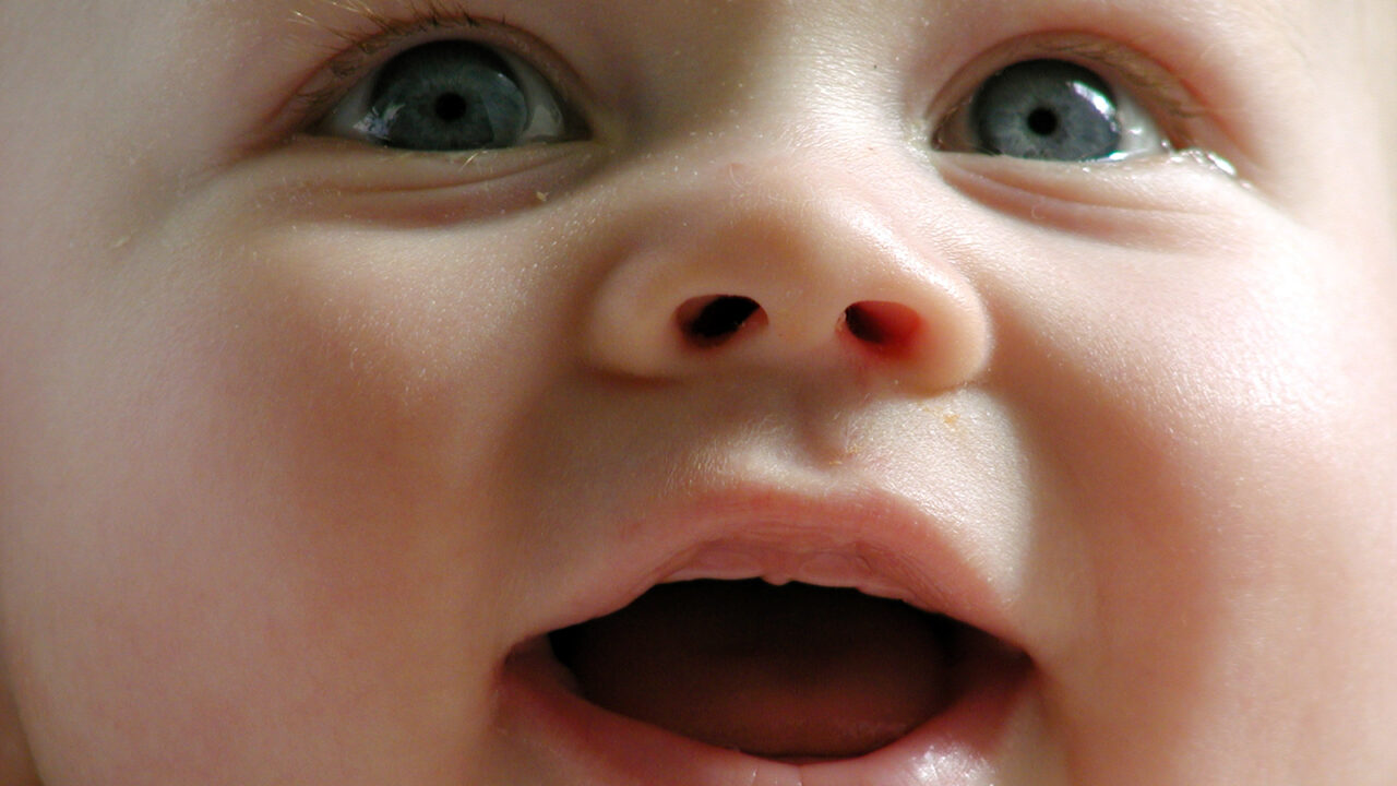 Shaken Baby Syndrome: the urgent need for prevention